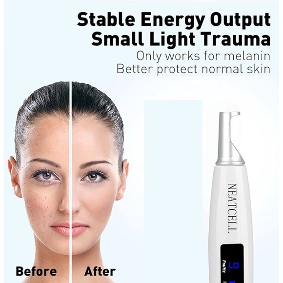 NEATCELL Picosecond Skin Laser Beauty Machine Tattoo Spot Removal Pigment Pen - Picture 6 of 6